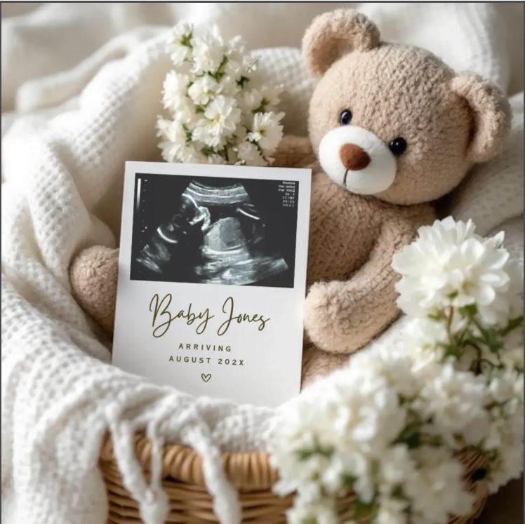 Pregnancy Announcement Empire Review (August 2025)