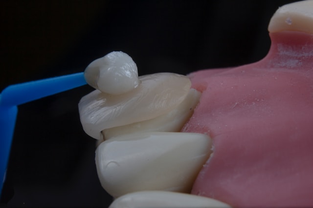 From Coffee Stains to Confidence: Glasgow&rsquo;s Most Trusted Teeth Whitening Experts