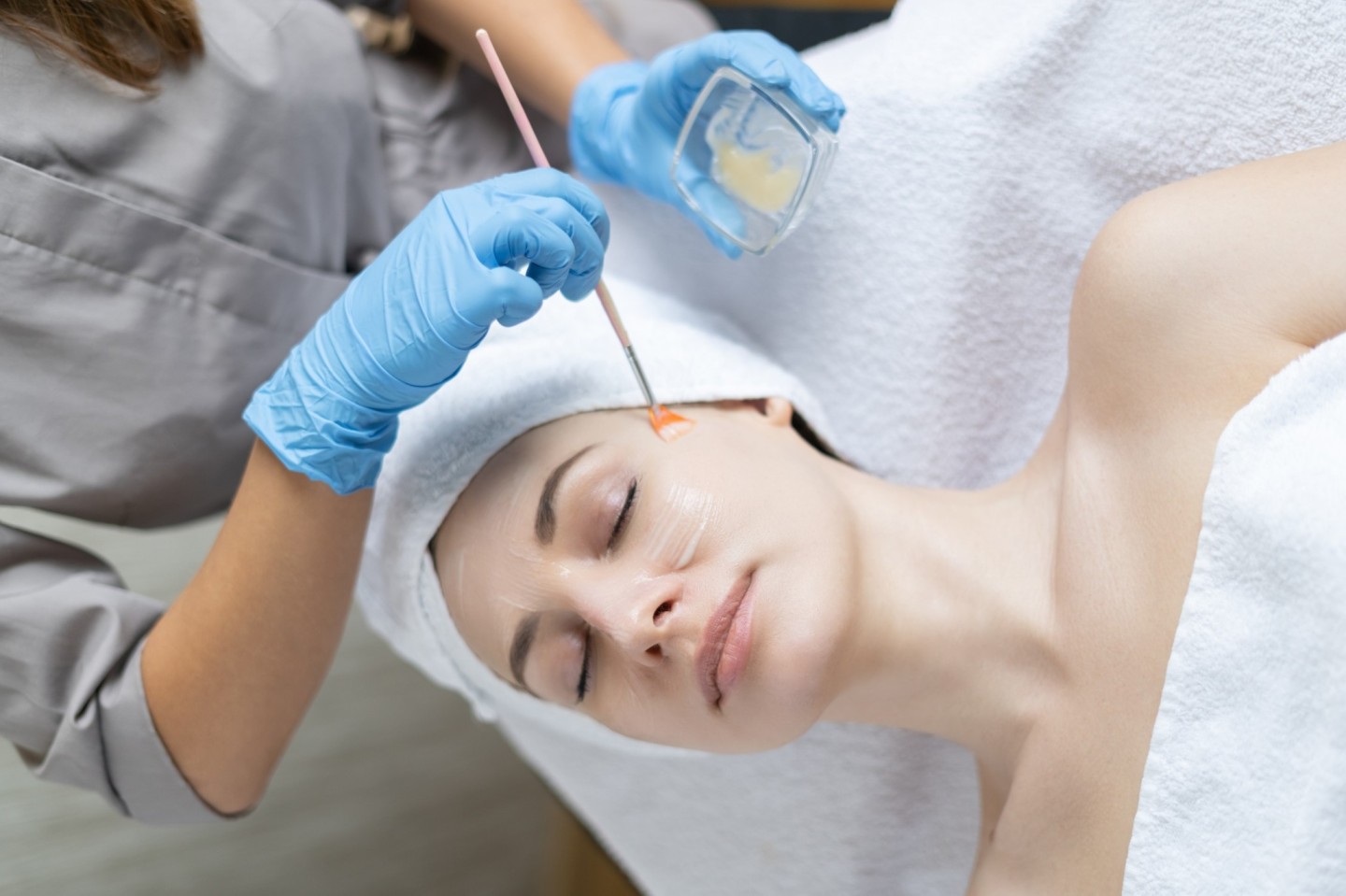 Chemical Peel Dubai: How Skin Resurfacing Helps Improve Pigmentation and Sun-Damaged Skin 