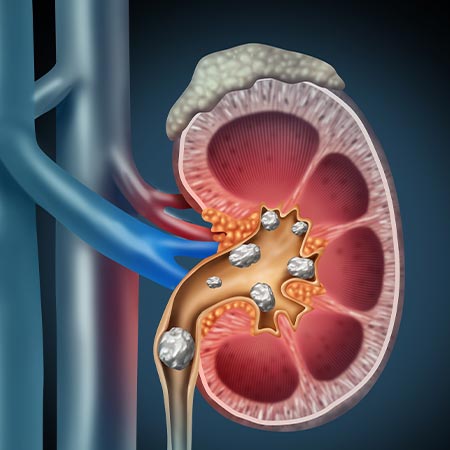 Best Urologist in Vijayawada: Why Patients Trust Dr. D. Shreedhar at Shreedhar Kidney Care Center